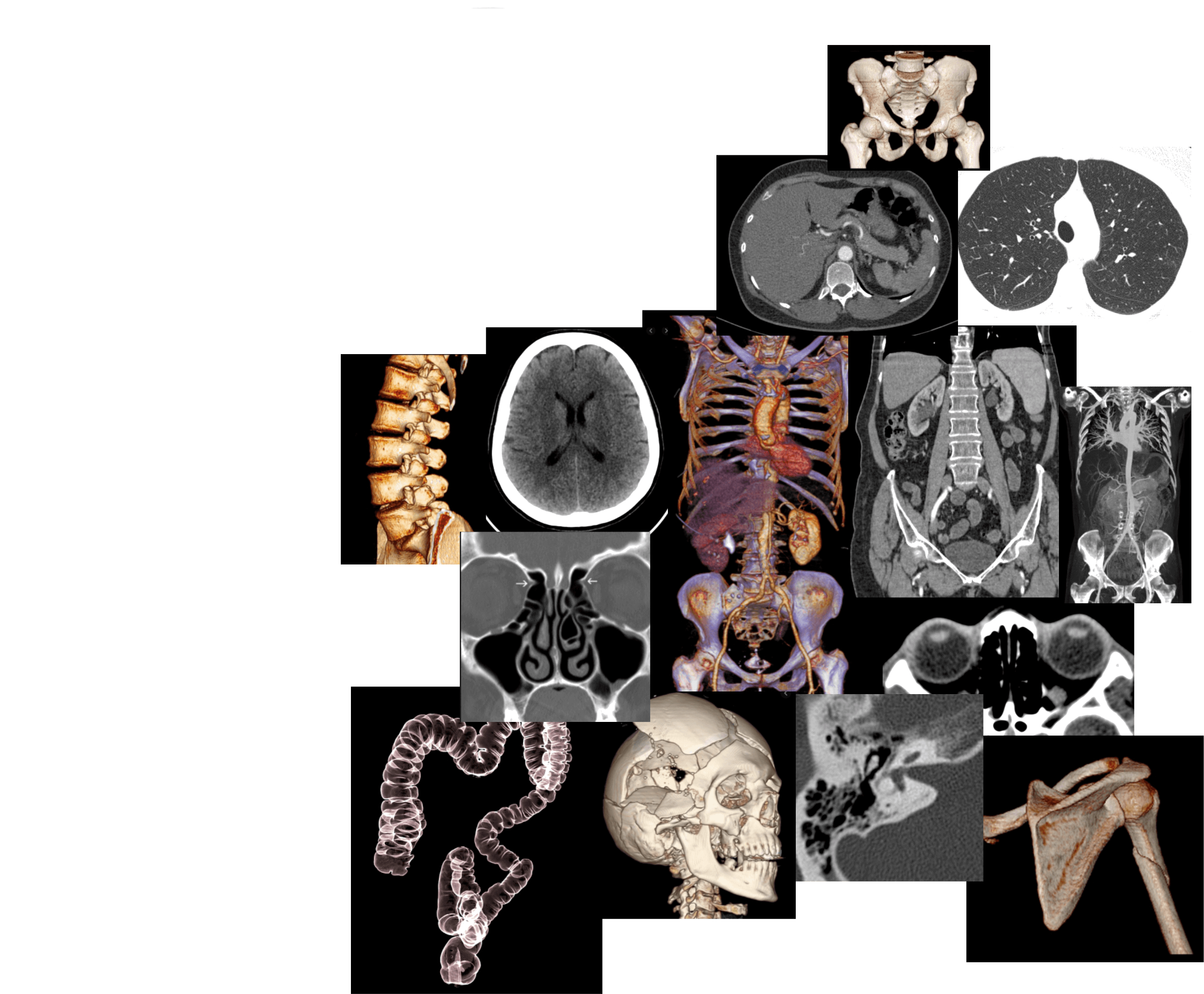 Mosaico de Tomografia
