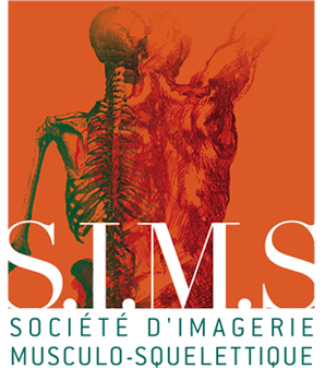 Société d’Imagerie Musculo-Squelettique